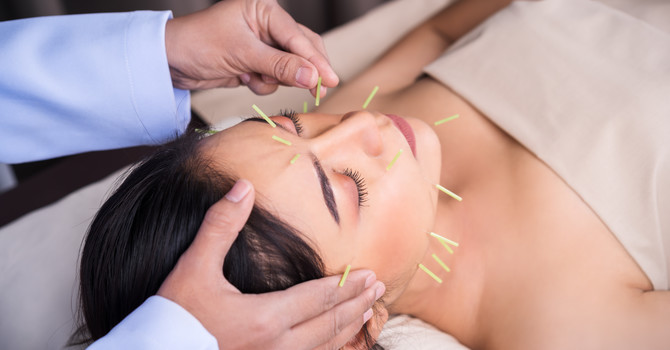 Facial Rejuvenation Acupuncture (Cosmetic Acupuncture) image
